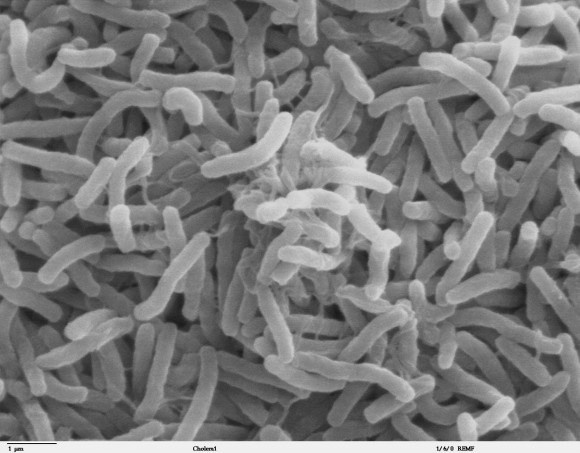 Vibrio cholerae, kolera eragiten duen bakterioa