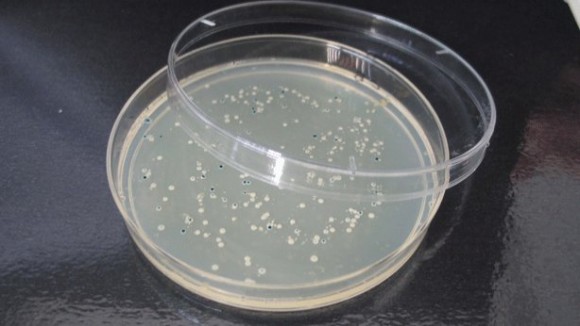 Mikroorganismoak: bakteriak agar-plaka baten