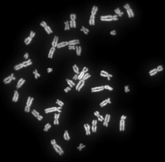 1. irudia: Kromosomak, herentziaren unitatea. (Argazkia: Abogomazova (Own work) CC-BY-SA-3.0, Wikimedia Commons bidez.)