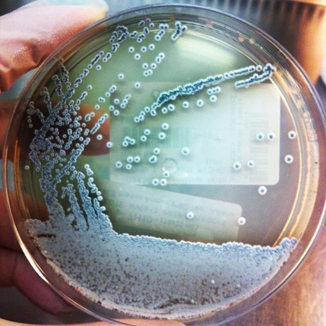 Bakterio espezie berria, &#8220;Nocardia donostiensis&#8221;