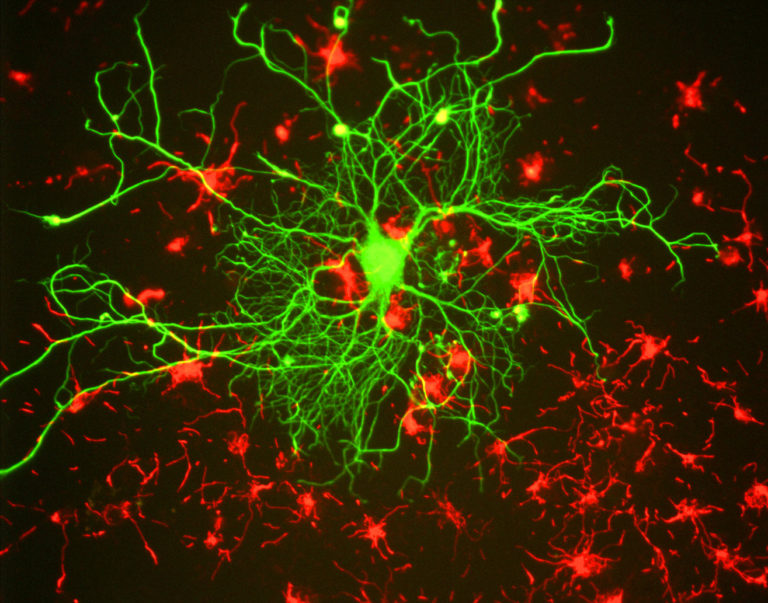 Sinapsien ikuspegi modernoa: zelulaz kanpoko matrizearen funtzioa konexio neuronalean