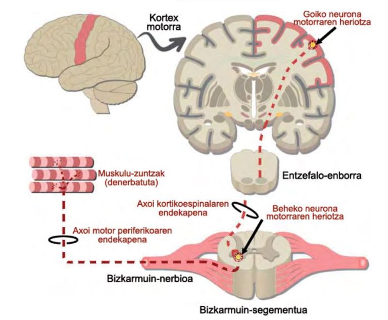 Biomarkatzaile molekularrak Alboko Esklerosi Amiotrofikoaren diagnostikoan