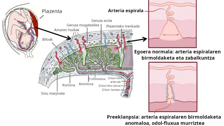 Nanopartikula lipidikoak: preeklanpsiaren tratamendurako itxaropena