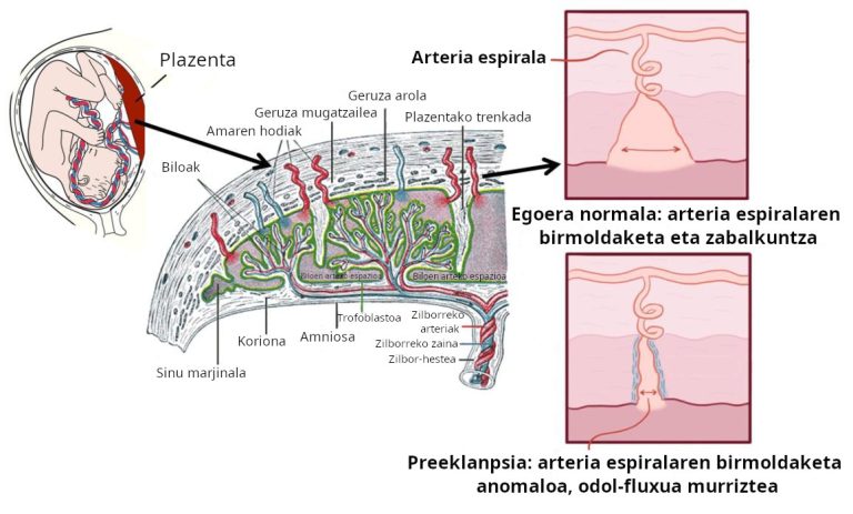 Nanopartikula lipidikoak: preeklanpsiaren tratamendurako itxaropena