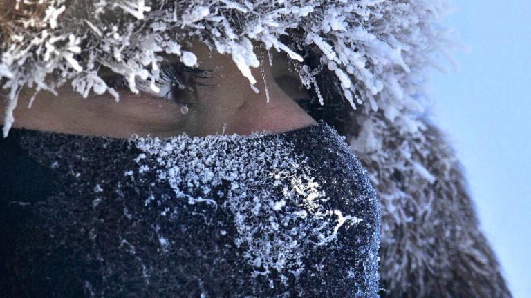 Zer eragiten du hipotermiak fisiologikoki?