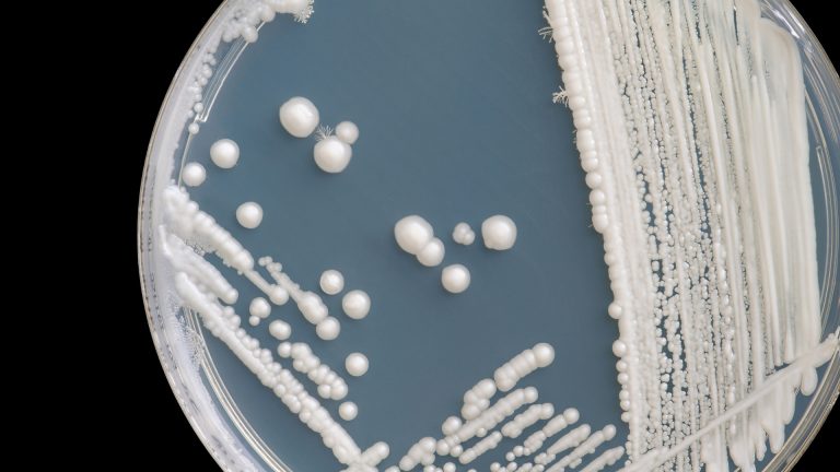 Gure gorputzean bizi den onddo batek melanoma agresiboago bihurtzen du