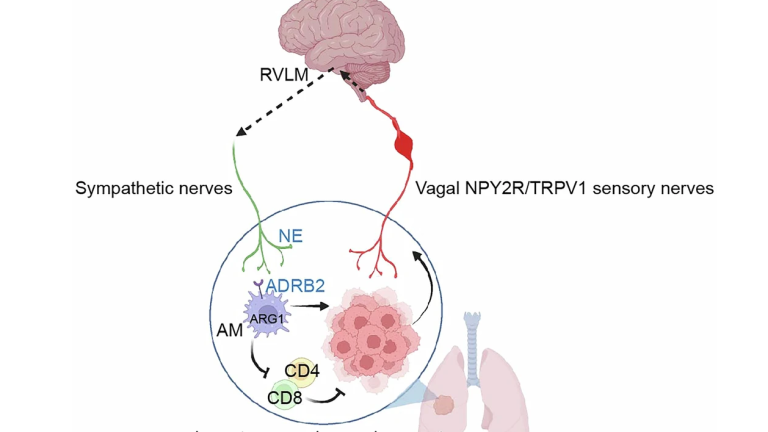 Biriketako tumoreek nola ahultzen duten immunitatea burmuinaren bidez