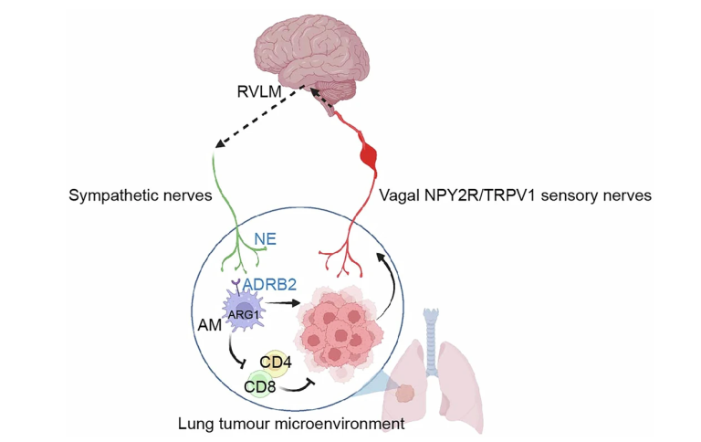 Biriketako tumoreek nola ahultzen duten immunitatea burmuinaren bidez