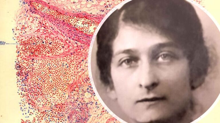 Gabrielle Charlotte Lévy, “estatua bizidunen” neurologoa